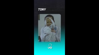 Tony | La Cura Del Polio