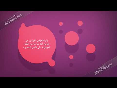 اليوم العالمي لسرطان الثدي