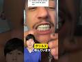 【雑学】グリルズについて解説します#Shorts