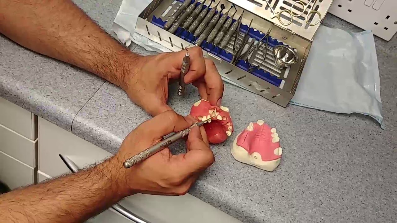 Dental video 2 YouTube