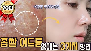 [02] 지긋지긋한 좁쌀 여드름 없애는 꿀팁 3가지 | 화장품 업계 16년차가 알려주는 근본 원인과 꿀팁 공개 | 3 Ways to Get rid of Small Acne