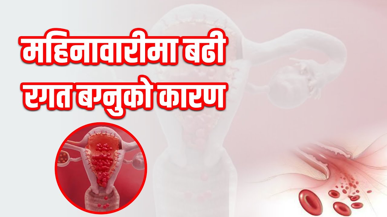 महिनावारीमा बढी रगत बग्नुको कारण | 𝐃𝐫. 𝐌𝐚𝐫𝐲𝐚𝐝𝐚 𝐌𝐚𝐥𝐥𝐚 𝐏𝐫𝐚𝐝𝐡𝐚𝐧