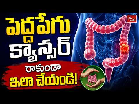 పెద్దపేగు క్యాన్సర్‌ రాకుండా ఇలా చేయండి! | hmtv health plus