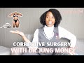 Corrective Surgery w/Dr. Jung + Mini Vlog