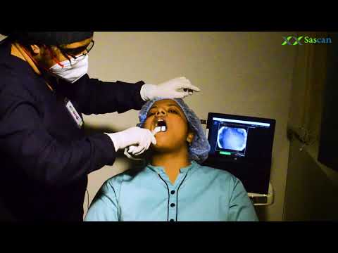 OralSan Working Video - video from Sāscan