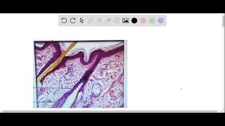 Label tne photomicrograph Of the Skin and Its accessory structures Sebaceous gland Duct ofl sebaceo…