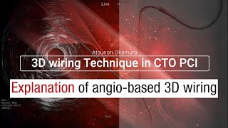 【English】Explanation of angio-based 3D wiring
