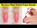 How to remove nail polish from hands and skin with out nail polish remover