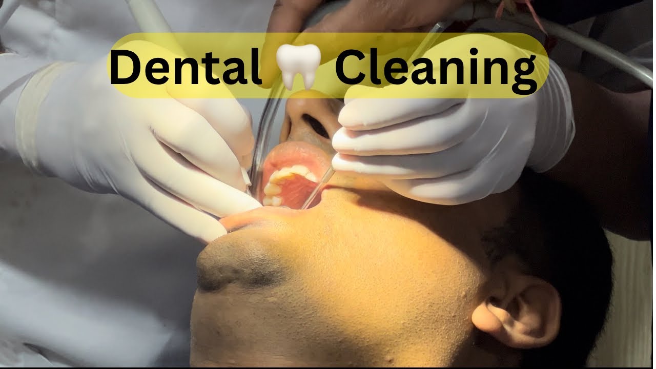 Dental Cleaning Oral Prophylaxis Oral Hygiene teeth cleaning