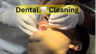 Dental Cleaning || Oral Prophylaxis || Oral Hygiene || teeth cleaning || Teeth N Pearl Dental Clinic