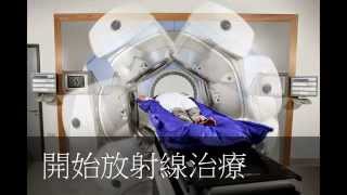 1分鐘認識-放射線治療