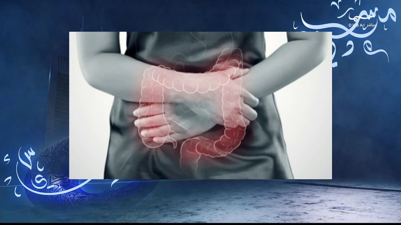 نقاش حول أمراض القولون والمستقيم والتغذية الصحية