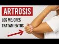 🟢 ¿Qué síntomas produce la ARTROSIS? Ayuda con SUPLEMENTACIÓN NUTRICIONAL (Dra. Susana Benito)