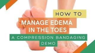 How to Manage Edema in the Toes: Compression Bandaging Demo