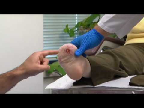 apma---diabetic-foot-ulcers---foot-care-for-diabetics---naps-tv