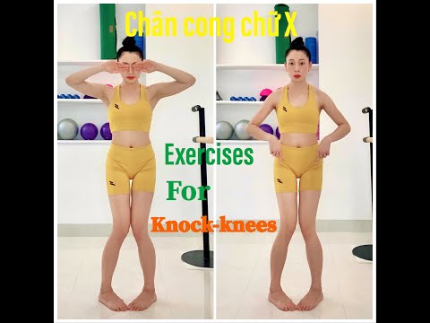 Chân chữ X làm sao cho thẳng/15 phút tập thẳng chân chữ X/Chân chữ X chữ O tập gì/chân vòng kiềng... Chân chữ X làm sao cho thẳng/15 phút tập thẳng chân chữ X/Chân chữ X chữ O tập gì/chân vòng kiềng...