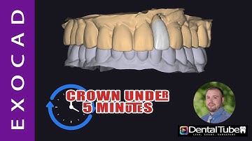 Exocad 3.2 Designing a crown under 5 minutes