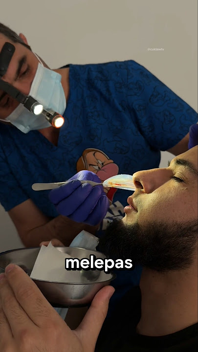 Strange Object in Patient's Nose