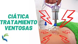 Sciatica treatment with SUCTION CUPS Fisiolution
