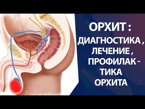 Орхит - лечение и диагностика