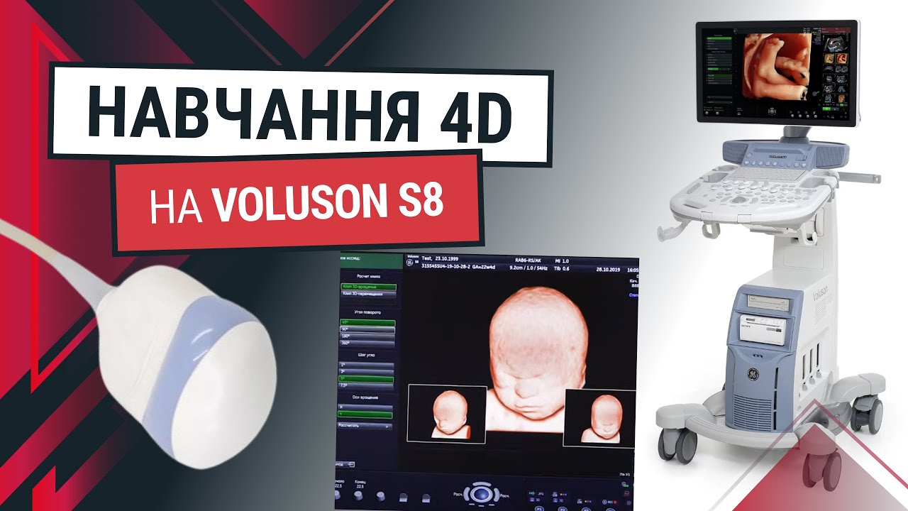 3D/4D конвесний датчик до GE Voluson S8 - навчання