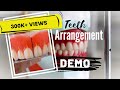 Teeth arrangement made easy! PART ONE
