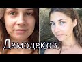 ДЕМОДЕКОЗ - ЛЕЧЕНИЕ мой опыт, косметика Demodex-Complex