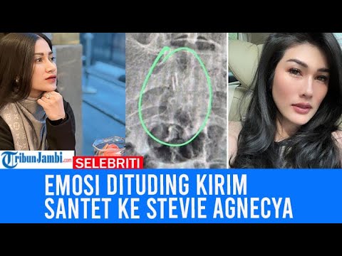 Selebgram Ini Emosi Dituding Kirim Santet ke Stevie Agnecya, Pilu Dizalimi Bertahun-tahun