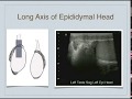 Testicular and Thyroid ultrasound