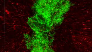 Astrocyte and PSD95 colocolization