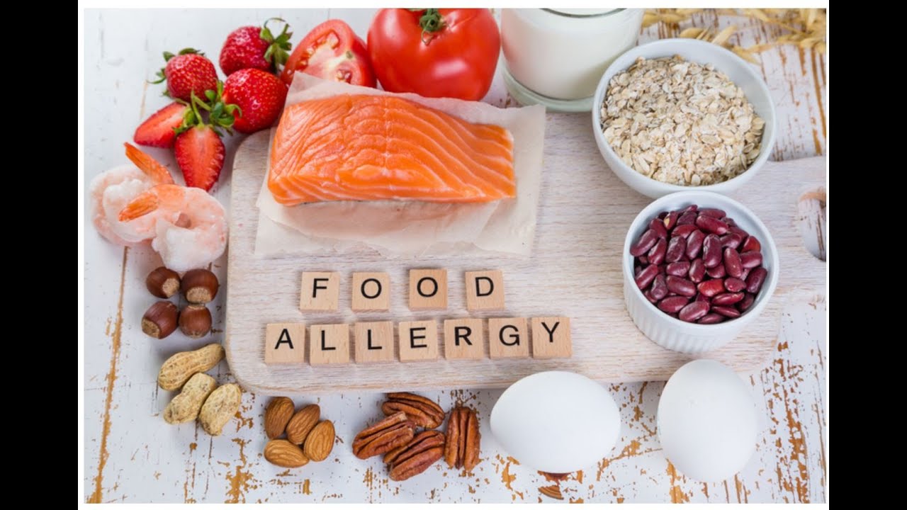 Food Allergen and types allergenic foods, symptoms cause by allergenic food and  control measures.