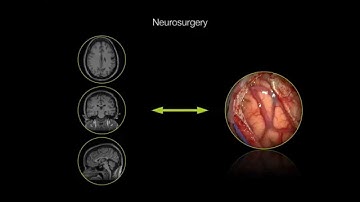 Augmented Reality in Neurosurgery Navigation