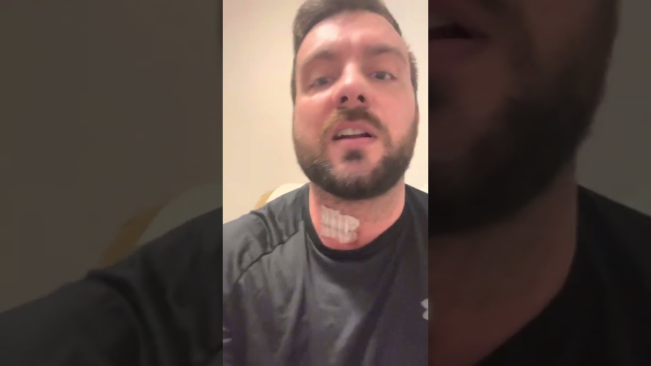 VID 2: Mobi-C cervical disc replacement (1 week post-op)