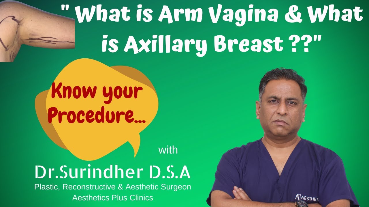 What Is Axillary Breast  What Is Arm Vagina Drsurindher -1709