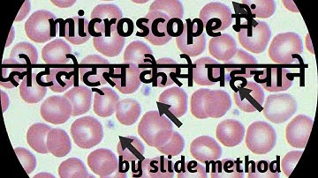 Microscopic platelets count by slide method