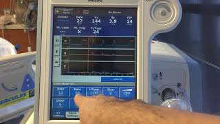 NonInvasive Ventilation [NIV]  Basics