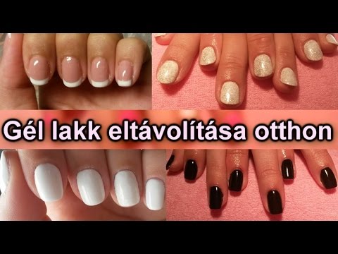 gél lakk otthoni eltávolítása