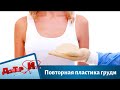 Повторная пластика груди | Доктор И