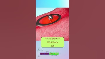 Những nguy hiểm khi xỏ khuyên lưỡi