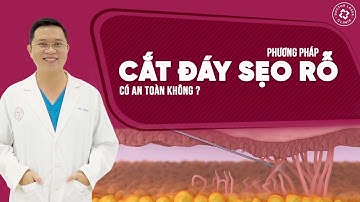 🍀Phương pháp cắt đáy Sẹo Rỗ có an toàn không? Các phương pháp điều trị Sẹo Rỗ tại Doctor Laser?