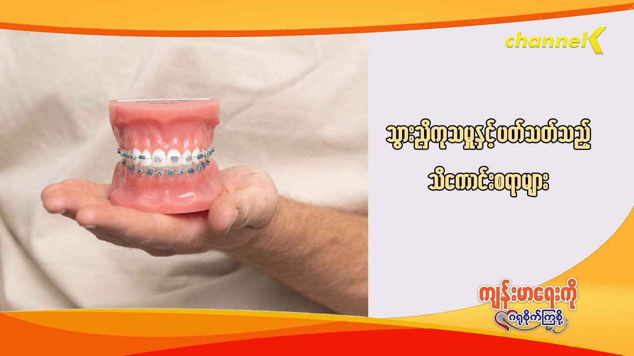 ကျန်းမာရေးကိုဂရုစိုက်ကြစို့ - အပိုင်း (၃၄) - သွားညှိကုသမှုများနှင့်ပတ်သတ်သည့် သိကောင်းစရာများ