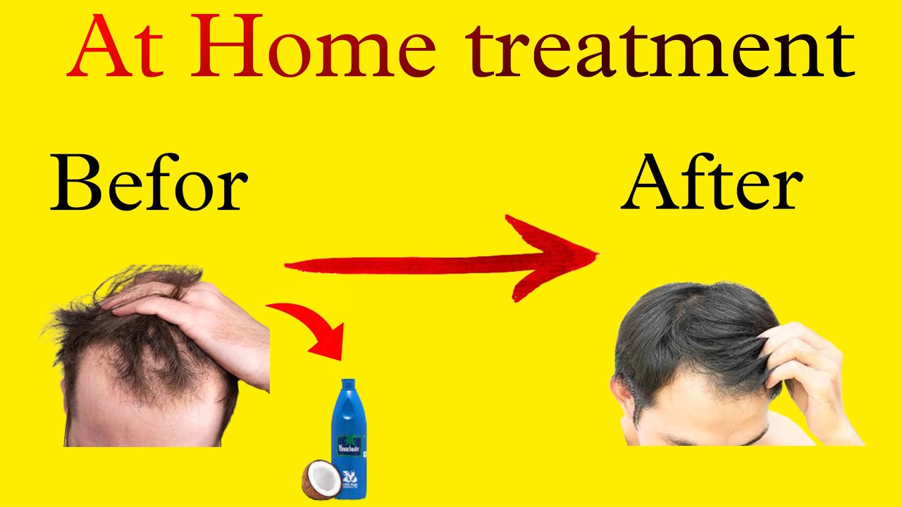 How to Apply COCONUT OIL Grow Long Healthy Hair 🌴🥥 YouTube