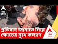 Kalyan Banerjee: বিক্ষোভে যোগ দিতে যাওয়ার সময় কল্যাণকে ঘিরে ধরে বিক্ষোভ | চোর স্লোগান