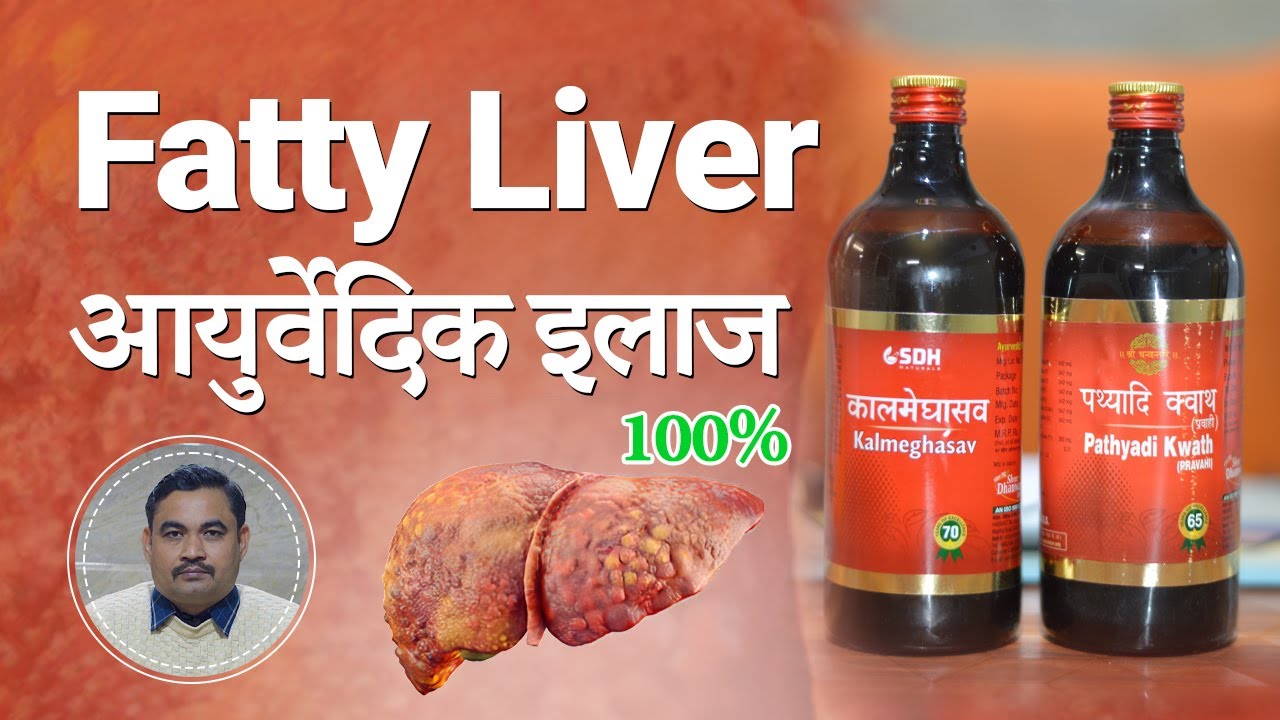 Fatty Liver 100% Ayurvedic Treatment | Rishiraj Ayurvedam