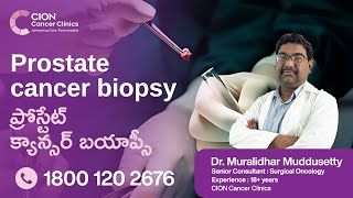 Play video: Prostate cancer biopsy in Telugu