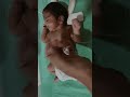 Neonatal Sucking Reflex Demonstration