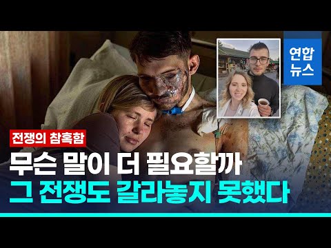 두 팔과 두 눈 잃은 우크라 병사…꼭 감싸 안은 아내  / 연합뉴스 (Yonhapnews)