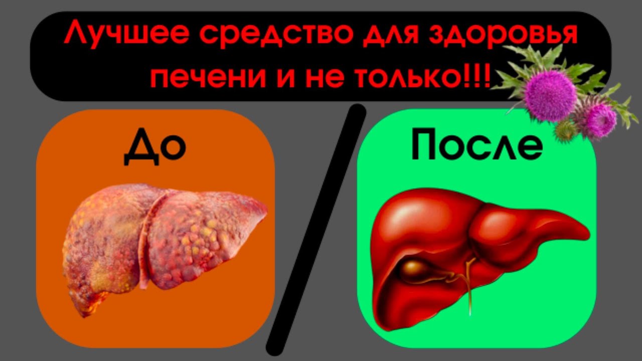 Лучшее народное средство для лечения печени и не только! - YouTube