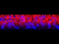 Human Epidermal Keratinocytes: HEK (5)