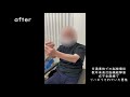 交通事故での脳挫傷後・右不全麻痺の方にリライブシャツを使った例